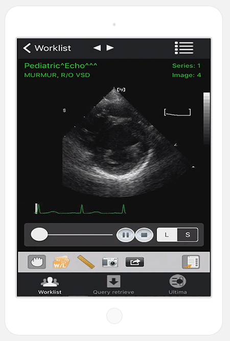 Mobile Dicom Viewer iPaxera View